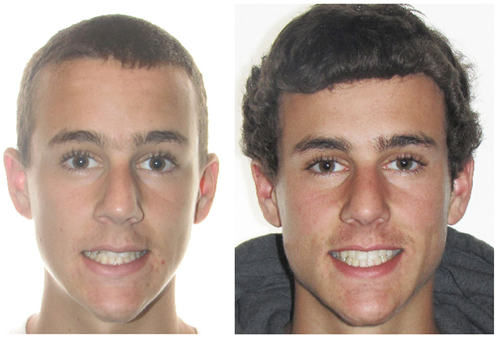 Precision Smiles, Inc.