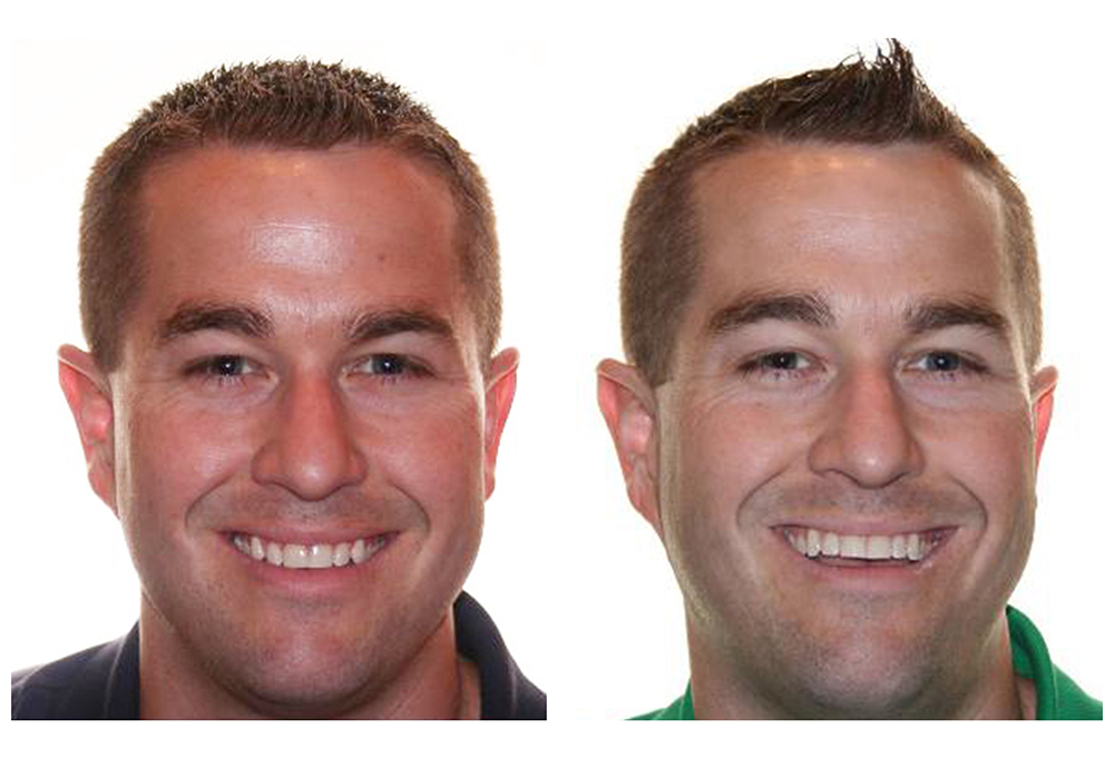 Precision Smiles, Inc.