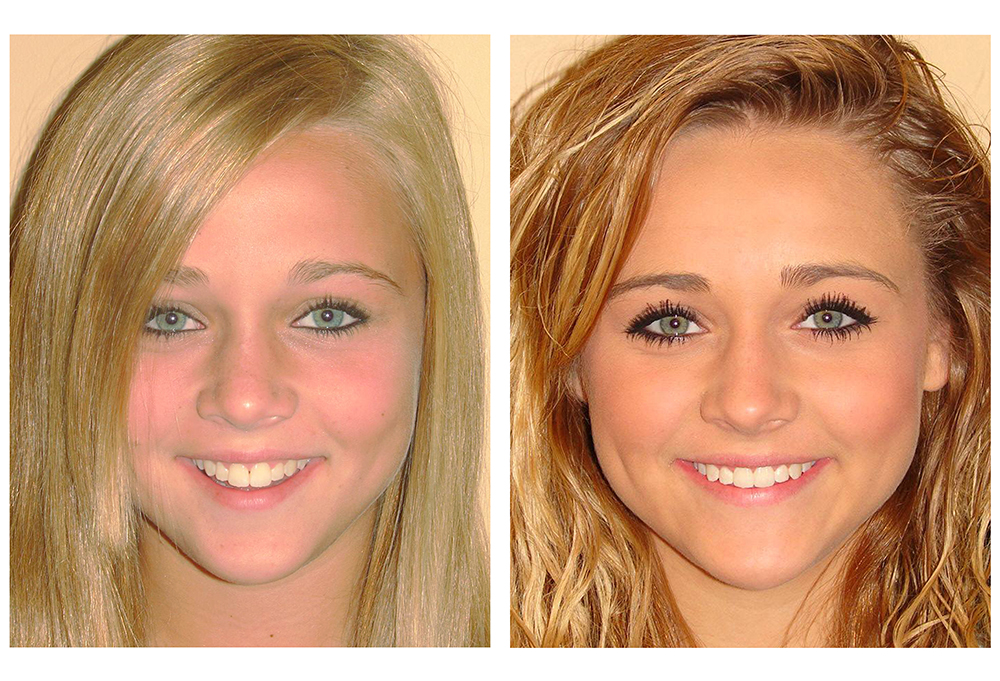 Precision Smiles, Inc.