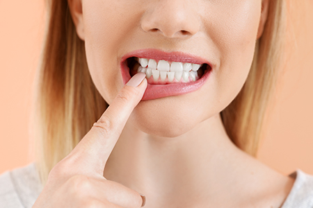Precision Smiles, Inc.